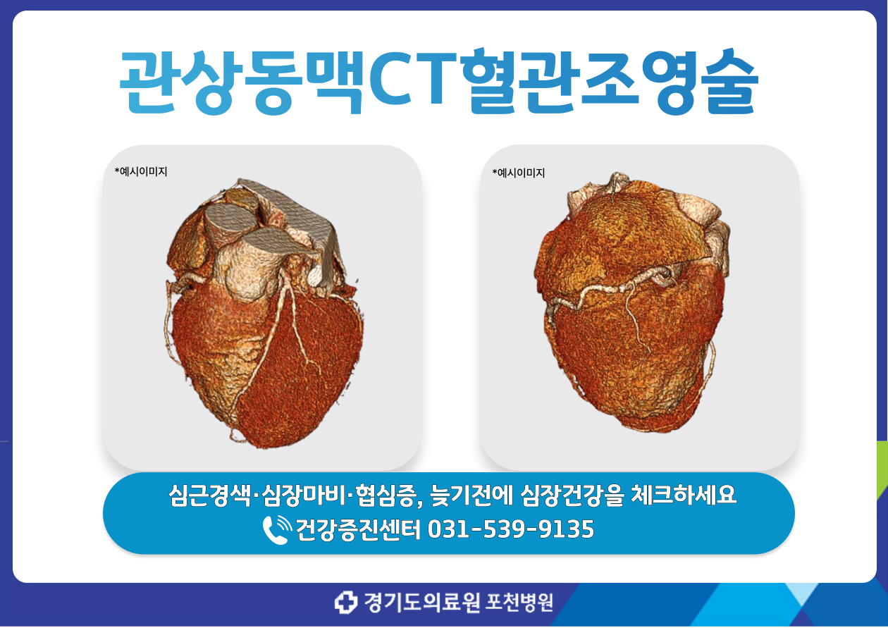 관상동맥CT